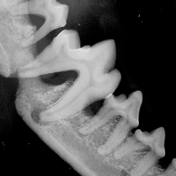 Dental Radiography