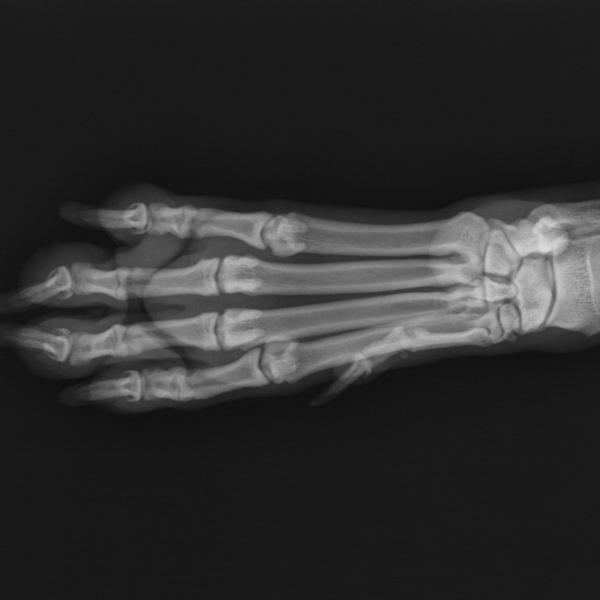 Radiographic Positioning