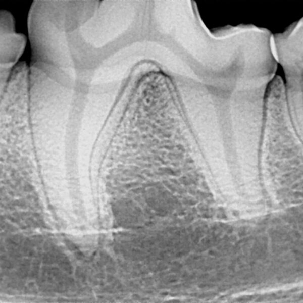 Dental Radiography